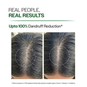 Bare Anatomy Anti Dandruff Shampoo & Hair Conditioner Combo | Helps Manage Flakes, Moisturizes & Reduces Frizz | 250 ml + 175 gm
