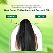 Dabur Vatika Enriched Coconut Hair Oil - 275 ml | For Strong, Thick & Shiny Hair | Controls Dandruff | Prevents Dull & Damage | Good for Scalp Health | Enriched with 10 Herbs