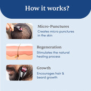 Man Matters Derma Roller with 540 Titanium Alloy Micro Needles 0.5 mm | Reduces Hair Fall | Stimulates Hair Follicles | Safe & Effective | Pack of 2