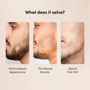 Man Matters BeardGro Beard Growth Serum for Men 30ml | 4% Anagain, 2% Aminexil, 1% Rosemary | Reduces Patchy Beard, Promotes Thicker Beard Growth | Lightweight and Fast Absorption