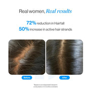 Be Bodywise 3% Redensyl & Rosemary Hair Growth Serum (Roll On) | Pack of 2 |with 2% Anagain | Thicker & Stronger Hair | Prevents Hairfall & Stimulates Hair Follicles | For All Hair Types | 50ml each