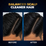 Beardo Studio Professional Scalp Balance Shampoo for Men | Salon-Grade Scalp Care at Home | Deep Cleansing Shampoo with Climbazole & Menthol | Helps Control Dandruff, Excess Oil & Itchy Scalp | 200ml