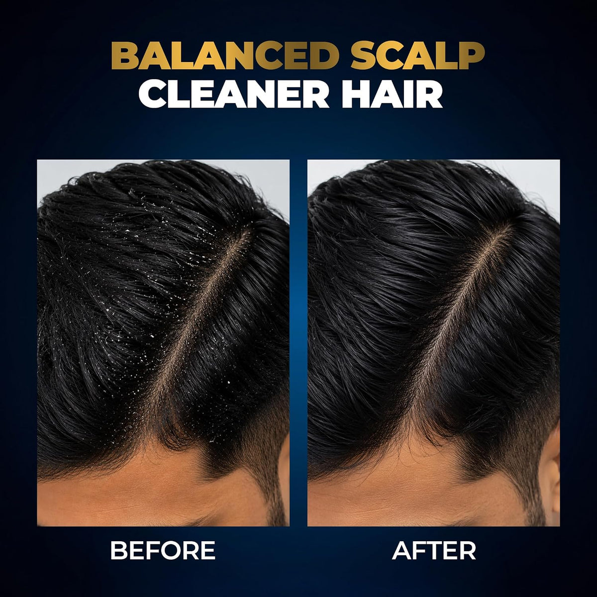 Beardo Studio Professional Scalp Balance Shampoo for Men | Salon-Grade Scalp Care at Home | Deep Cleansing Shampoo with Climbazole & Menthol | Helps Control Dandruff, Excess Oil & Itchy Scalp | 200ml