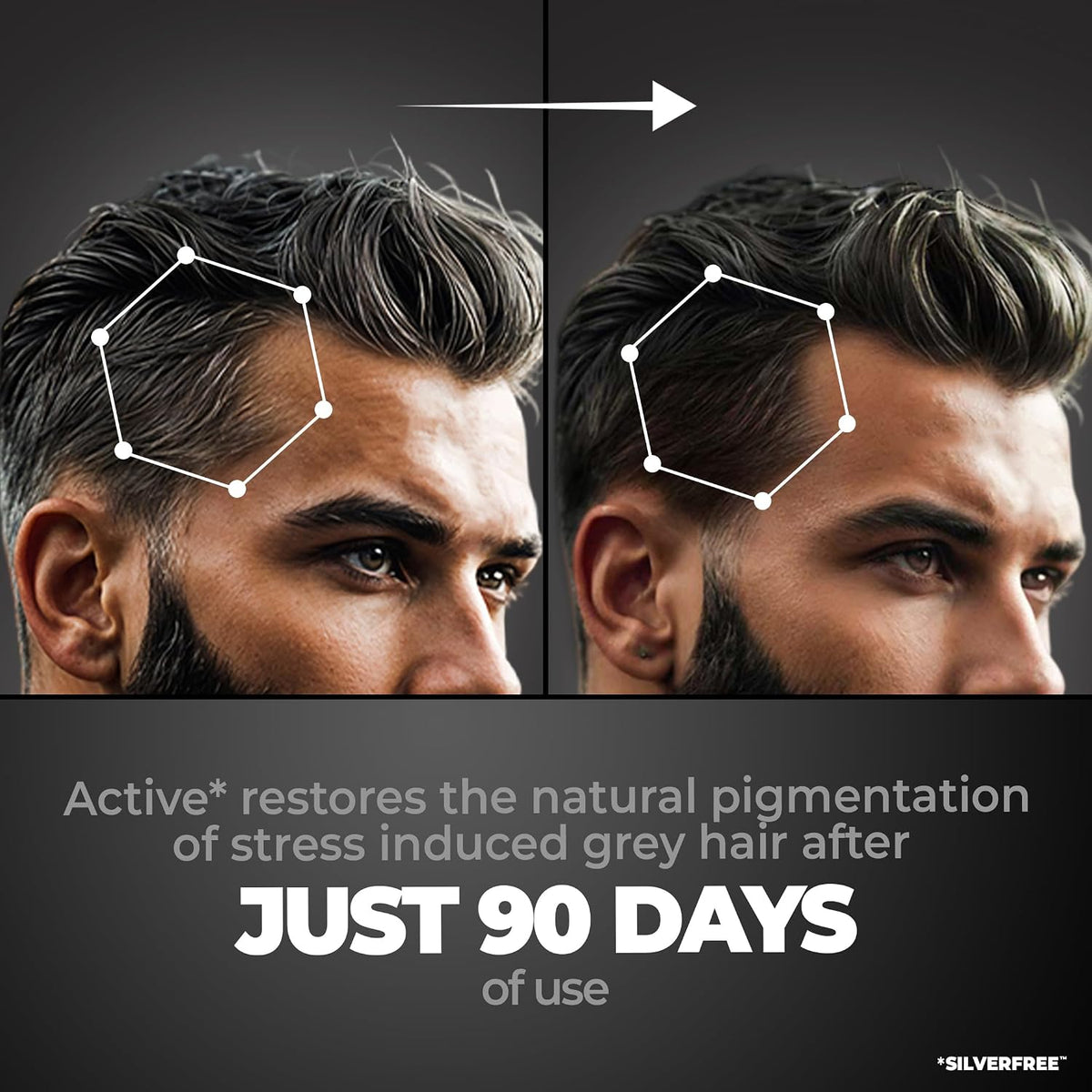 Beardo Anti Grey Hair Serum for Men, 50 ml | SilverFree™ Formula | Also contains Amla + Methi + Rosemary + Brahmi + Bhringraj extracts for Hair Shine | Lightweight and Non-Sticky