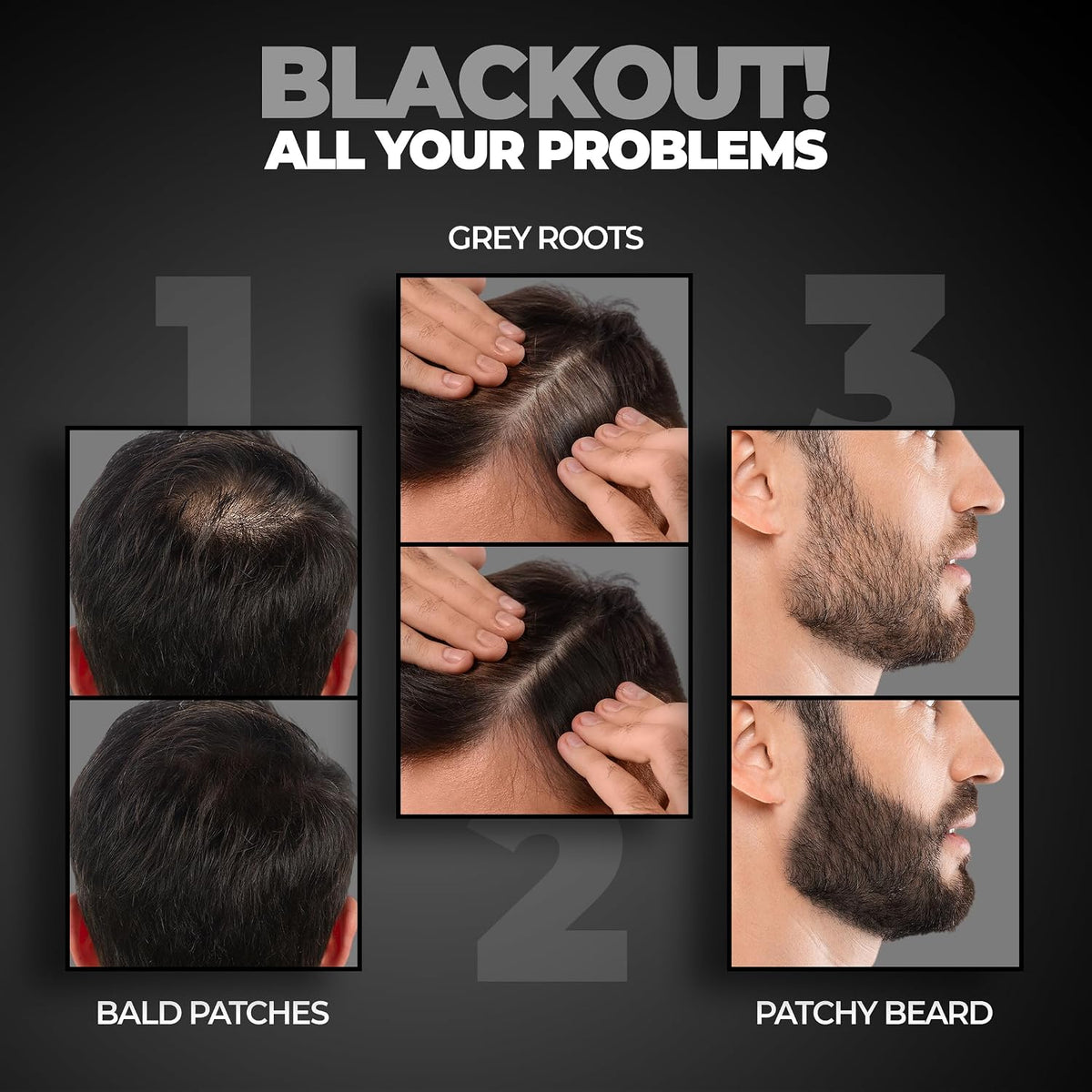 Beardo Grey Fix Kit for Men | Anti-Grey Hair Serum, Beard Oil & Blackout Powder | Reverse Greying, Restore Natural Look | Root Touch Up for Hair | Kit for Men-Set of 3