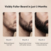 Man Matters BeardGro Beard Growth Serum for Men 30ml | 4% Anagain, 2% Aminexil, 1% Rosemary | Reduces Patchy Beard, Promotes Thicker Beard Growth | Lightweight and Fast Absorption