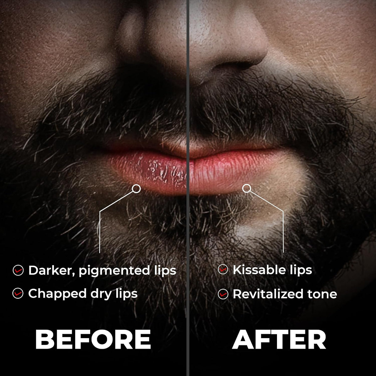 Beardo Lip Lightener for Men with Kojic Acid & SPF 30, 7g | Non-Tinted Brightening Lip Balm | Lip Balm for Dark, Dry & Chapped Lips | Men’s Lip Care for Smooth, Soft & Pink Lips