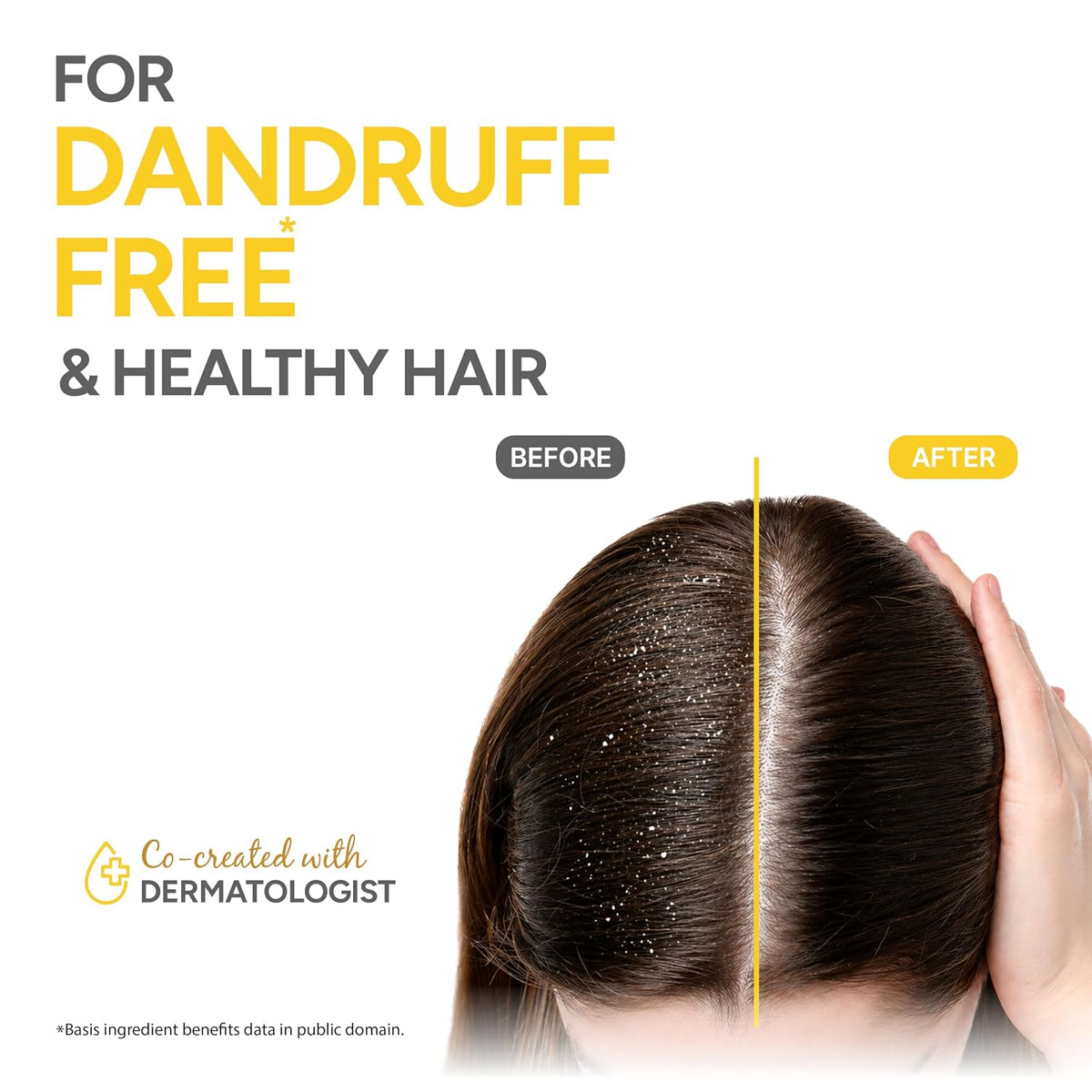 Dabur Vatika Naturals Anti Dandruff Shampoo - 640 ml | 7 Natural Herb Extracts | Contains Lemon, Methi & Tea Tree Oil | Exfoliates Flaky Scalp for Dandruff-Free Hair | Everyday Shampoo for Women & Men