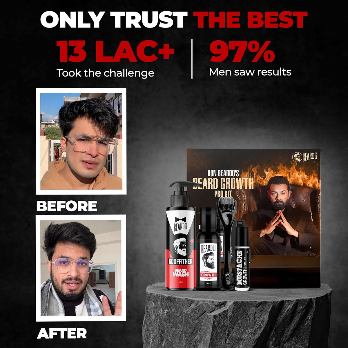 BEARDO Don’s Beard Growth Pro Kit | Complete Beard Growth & Grooming Kit for Men | Ideal Gift for Men | Beard Care Starter Kit | Gift for Husband