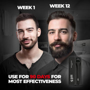 Beardo Beard Activator Derma Roller for Men, 540 - 0.5mm Chromium needles, Stimulates Hair Growth | Follicles activation | No Patchy Beard with Hair Growth Derma Roller