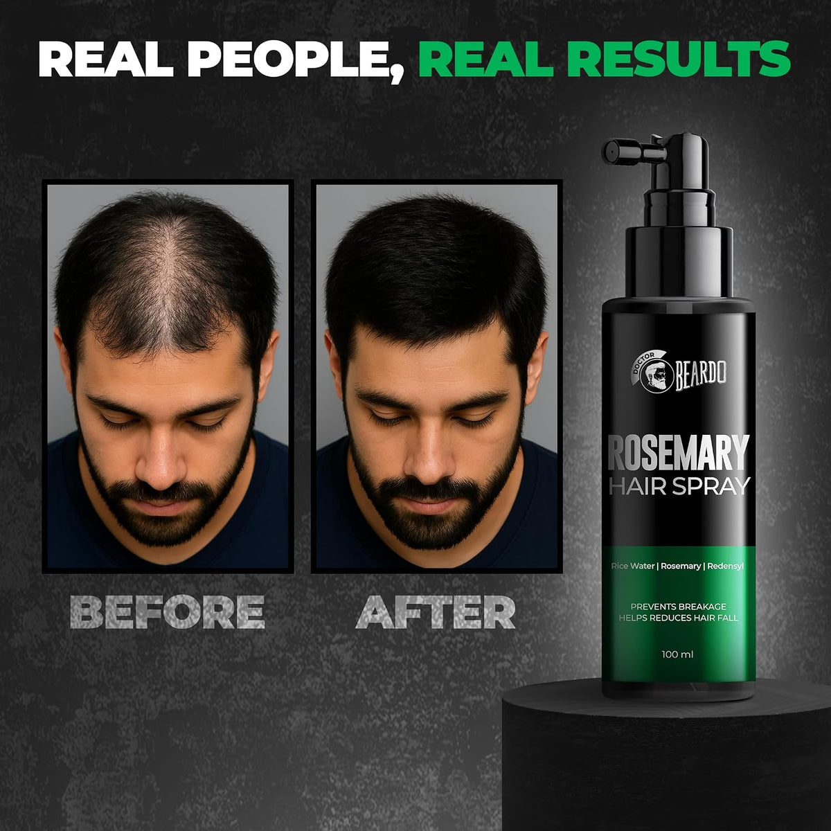Beardo Rosemary Hair Spray with Redensyl & Rice Water | Activates Natural Hair Growth, Reduces Hair Fall & Breakage | Strengthens Roots | Non-Sticky Daily Hair Tonic for Men- 100ml