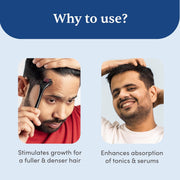Man Matters Derma roller 1.00 mm With 540 Titanium Alloy Needles | Promotes Beard Growth & Reduces Acne Scars | Safe & Effective To Use