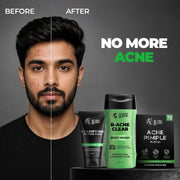 Beardo Acne Ka The End Kit for Men | 2% Salicylic Acid Face Wash, Body Wash & Pimple Patch | Helps Fight Face & Body Acne, Controls Excess Oil | Complete Acne Care Kit
