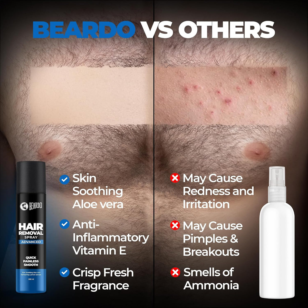BEARDO Hair Removal Spray for Men | Painless & Irritation Free Spray | For Chest, Back, Legs & Under Arms | Aloe Vera & Lemon | Gentle on Skin | No Burning or Itching | Brightening De-Tan Formula - 200ml