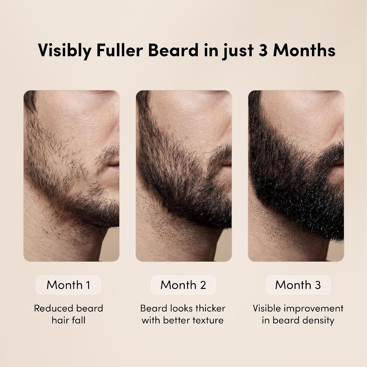 Man Matters BeardGro Beard Growth Serum for Men 30ml | 4% Anagain, 1% Rosemary, 2% Aminexil | Promotes Thicker Beard Growth, Reduces Patchy Beard , Fast Absorption and Lightweight | Pack of 2
