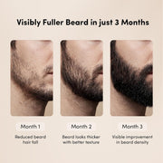 Man Matters BeardGro Beard Growth Serum for Men 30ml | 4% Anagain, 1% Rosemary, 2% Aminexil | Promotes Thicker Beard Growth, Reduces Patchy Beard , Fast Absorption and Lightweight | Pack of 2