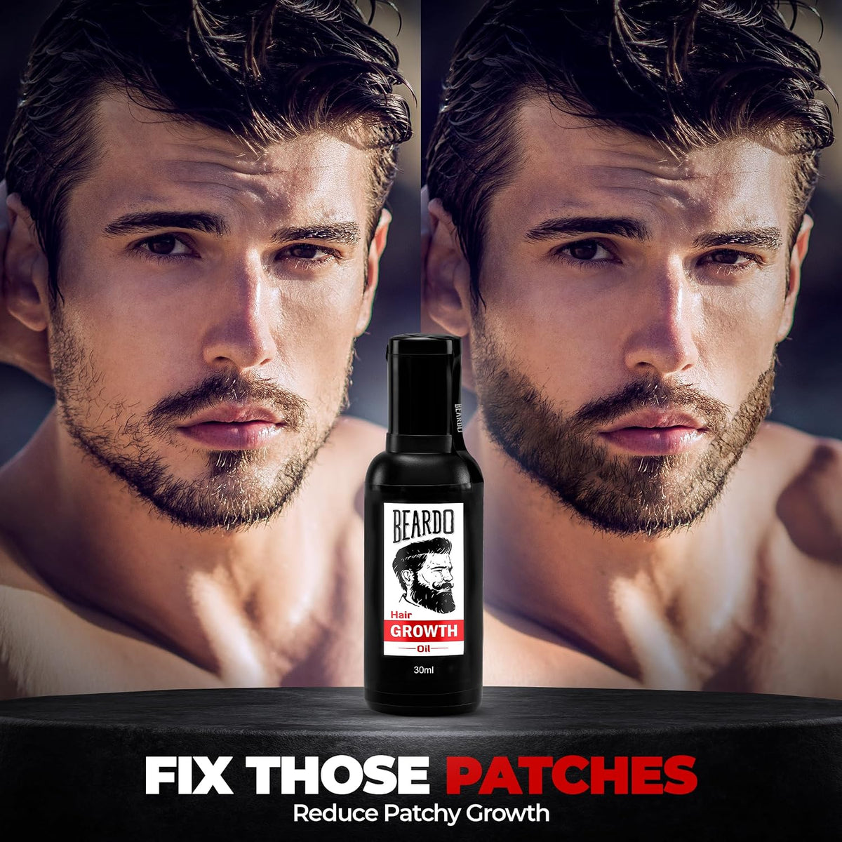BEARDO Mustache Growth Roll On 8ml, Beard & Hair Growth Oil 30ml with Derma Roller | Beard Growth Kit for Men, Hair Regrowth, Patchy Beard Treatment, Grooming Combo (Pack of 3)